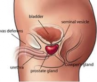 uretritis- prosztatitis ami megjelenik